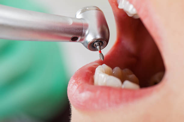 Best Emergency Dental Care for Broken or Chipped Teeth in Chagrin Falls, OH